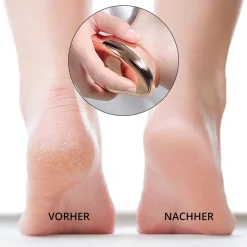 Ailoria Doucette Pro Hornhautentferner Set Orange