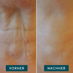 Apricot Wiederverwendbares Hals Pad mit Hyaluron