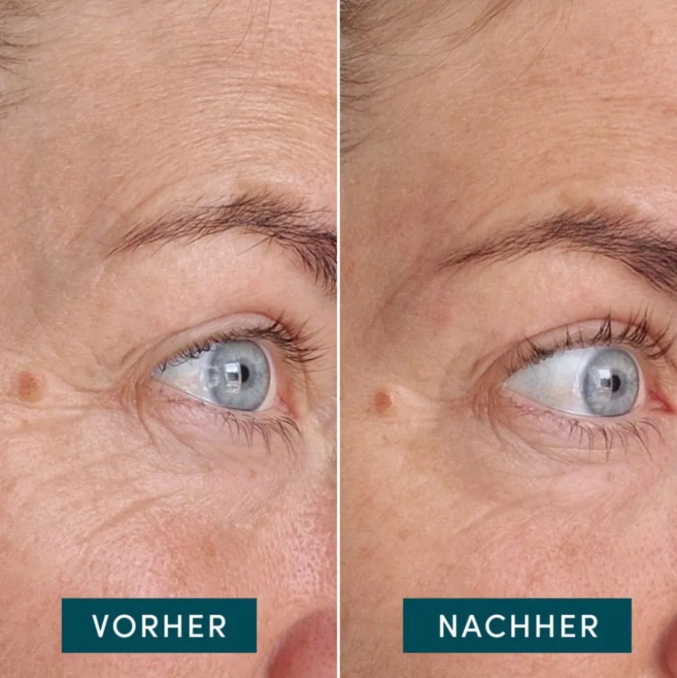 APRICOT Wiederverwendbare Augen-Schläfen Pads mit Ectoin