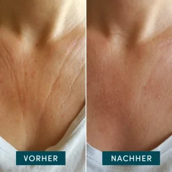 APRICOT Wiederverwendbares Dekolleté Pad mit Hyaluron