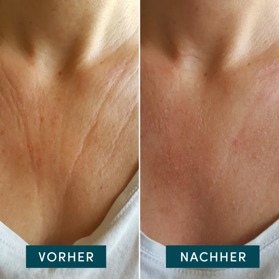 APRICOT Wiederverwendbares Dekolleté Pad mit Hyaluron