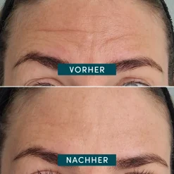 APRICOT Wiederverwendbares Stirn-Pad mit Ectoin