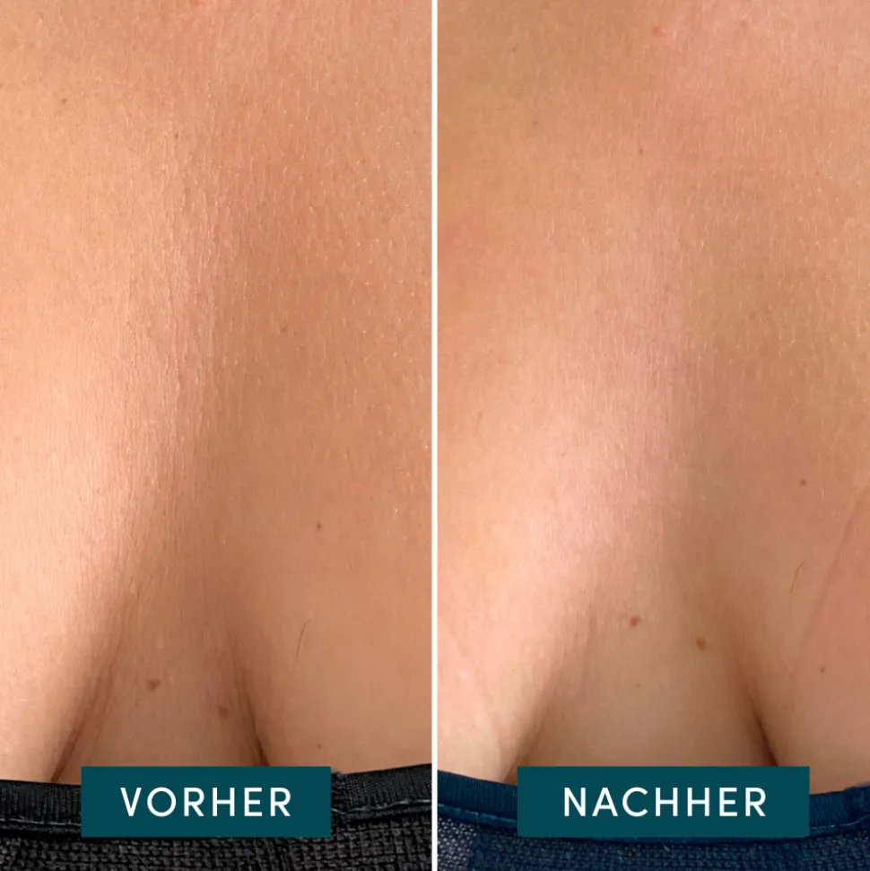 APRICOT Wiederverwendbares Dekolleté Pad mit Aloe Vera