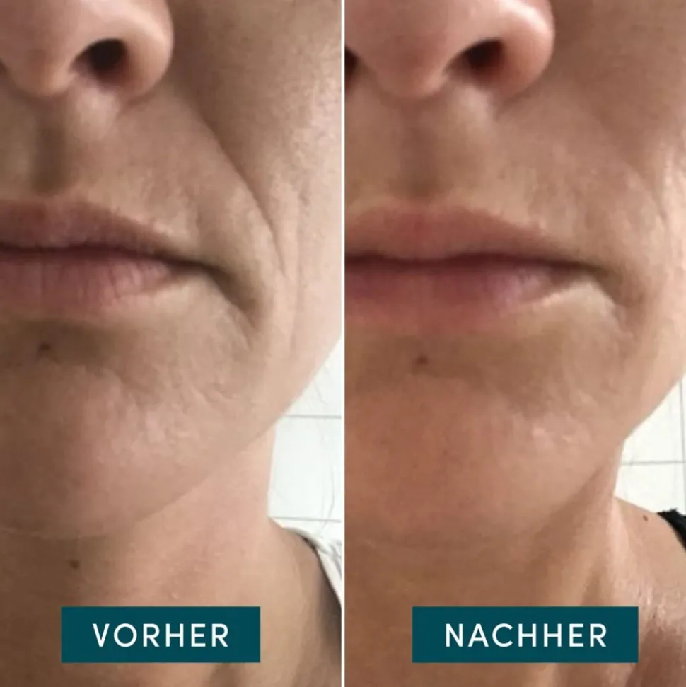 APRICOT Wiederverwendbare Mund Pads mit Hyaluron