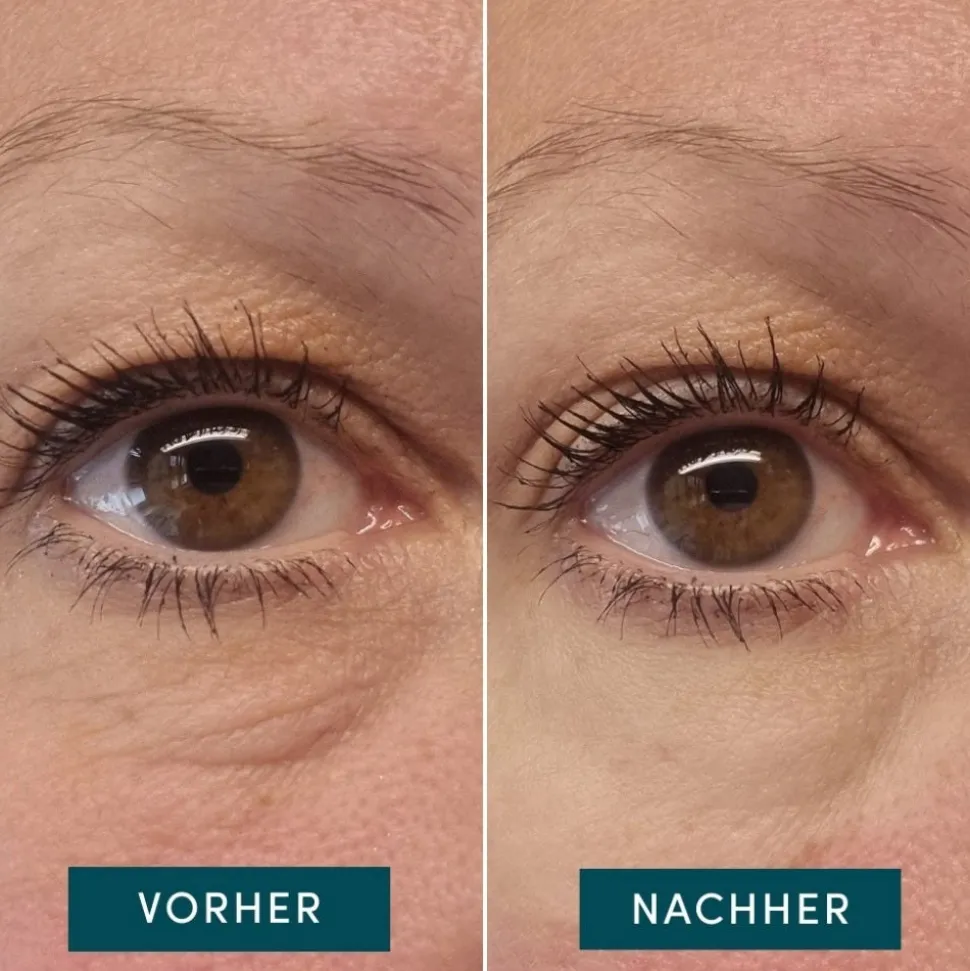 APRICOT Wiederverwendbare Augen-Schläfen Pads mit Hexapeptid-Technologie Limited Edition 2 Stück