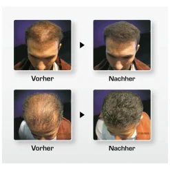 Biothik Haaraufbau-Faser S5 dunkelblond 15 g