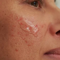 DADO SENS SENSACEA Intensivserum 50 ml