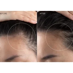 FAQ Swiss 301 LED Hair Strengthening Scalp Massager