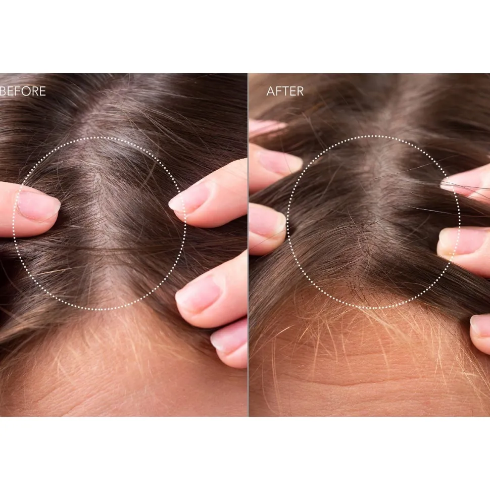 FAQ Swiss Scalp Recovery & Thick Hair Probiotic Serum 60 ml