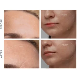 FOREO Sweden KIWI derma