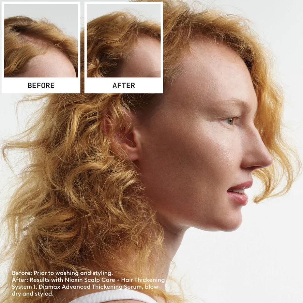 Nioxin Scalp + Hair System 1 Conditioner 300 ml