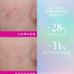 NUXE Zinc Power Serum 30 ml