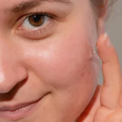 Rosental Organics Akne Serum 30 ml