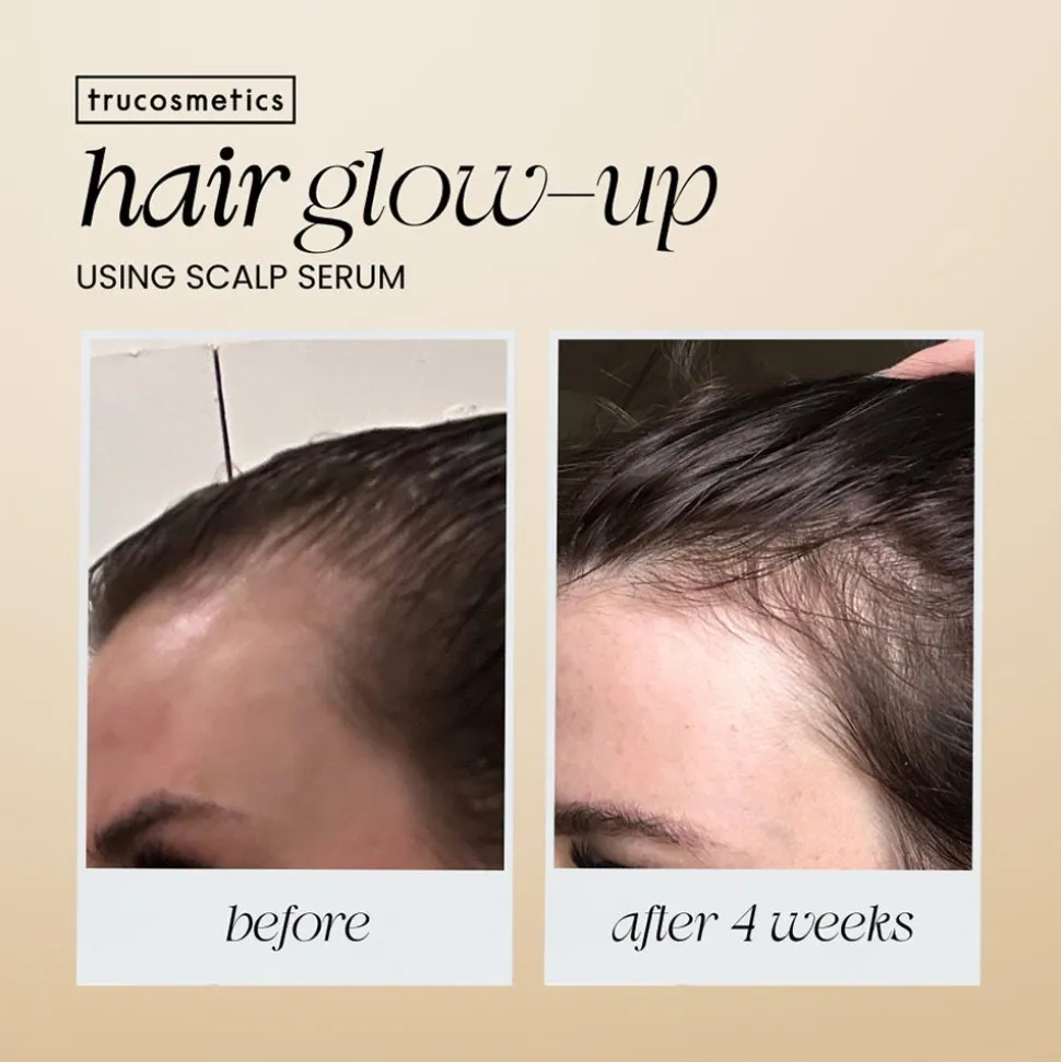 Trucosmetics Hair Growth Serum 50 ml